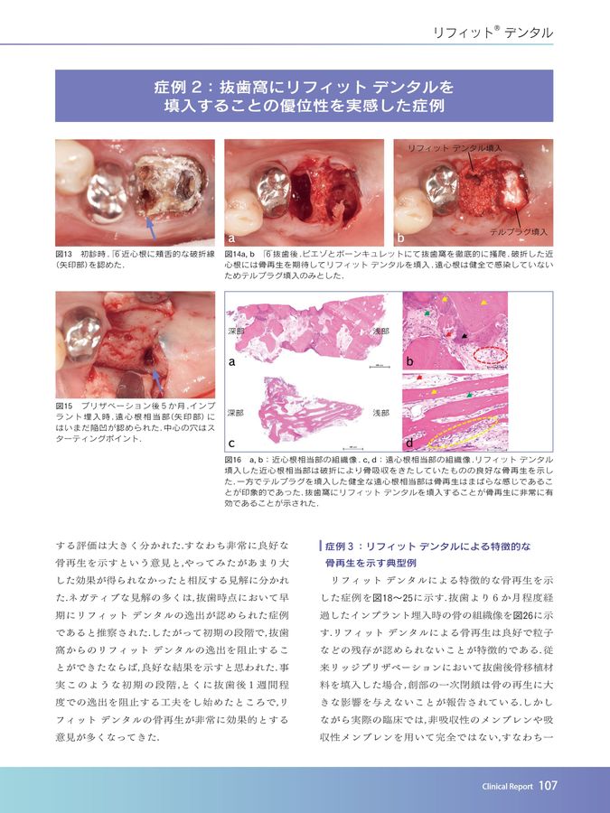 TQ別冊骨補填材料＆メンブレンYB2023／2024
