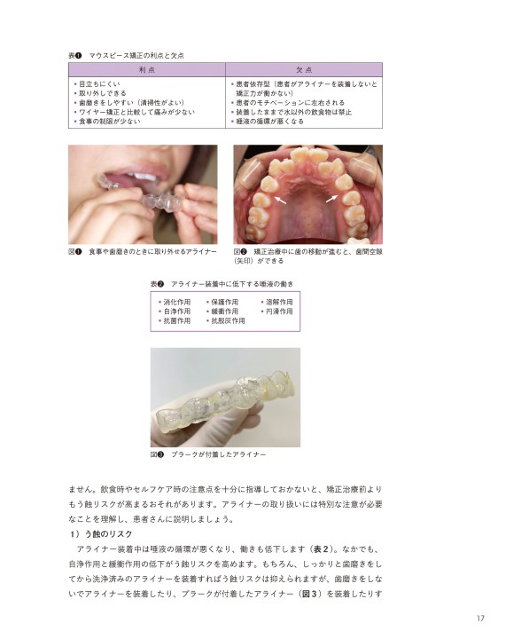 歯科医師＆歯科衛生士のためのマウスピース矯正入門