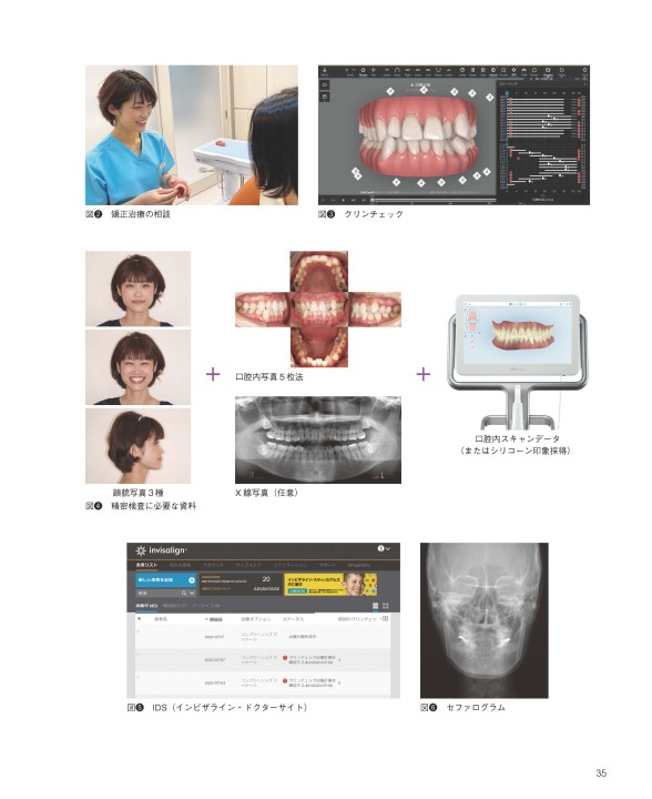 歯科医師＆歯科衛生士のためのマウスピース矯正入門