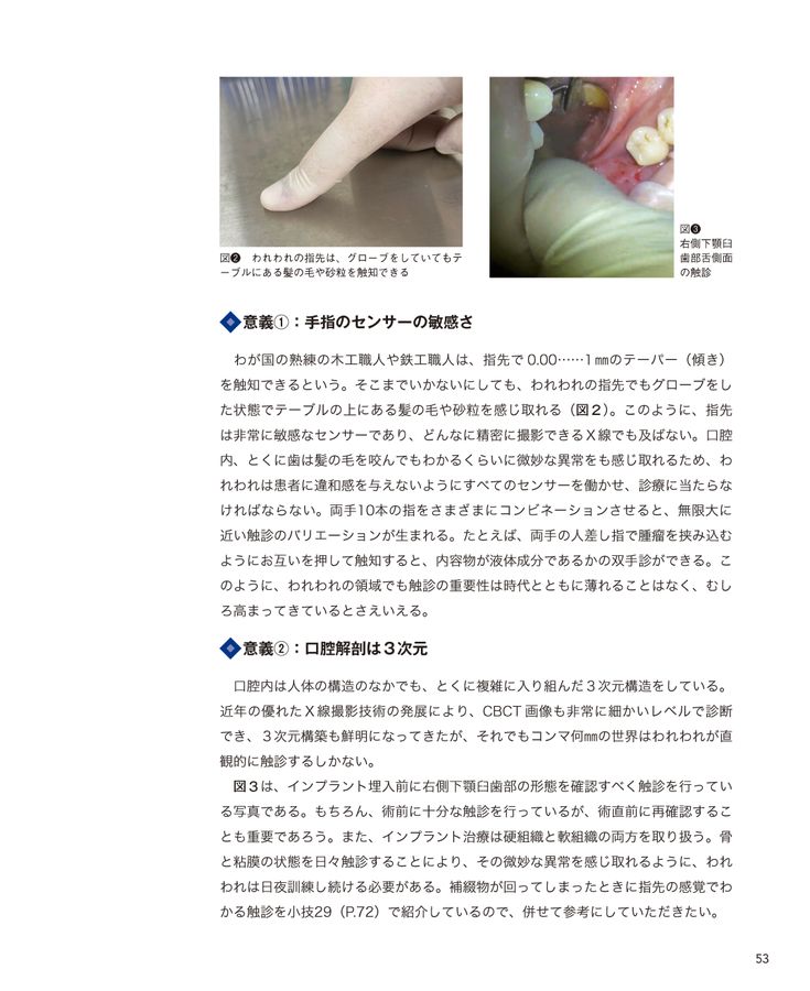インプラント小技帖50 インプラント小技帖50