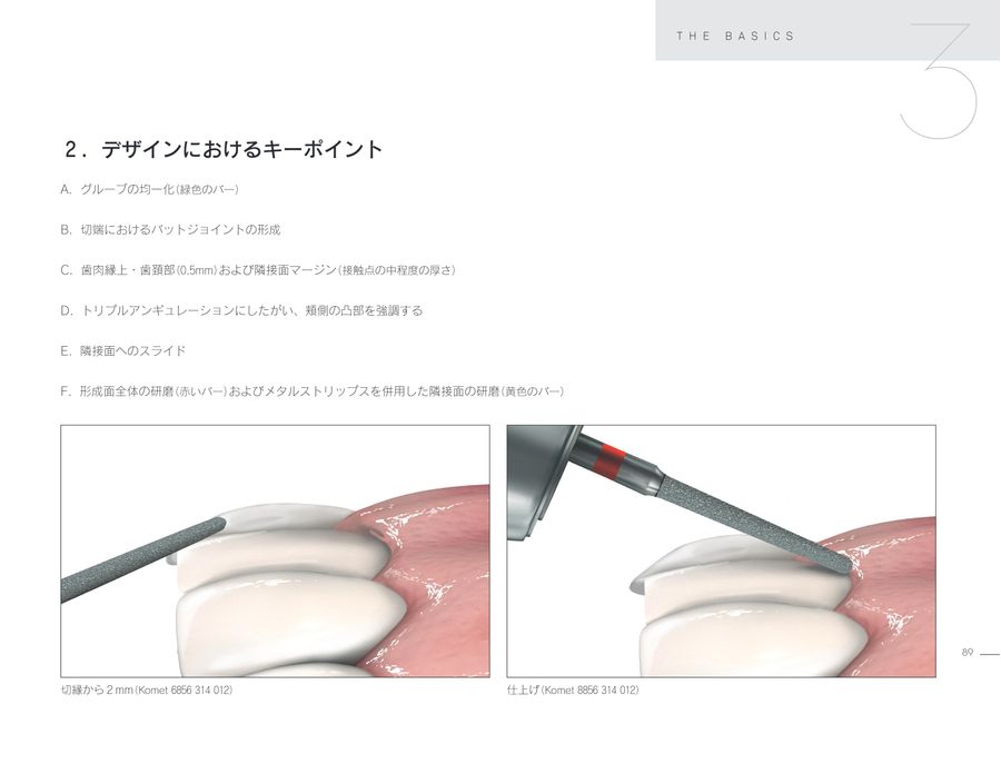 ※裁断済み　ラミネートベニア スマイルデザインのレシピ20 Amazon.co.jp: ラミネートベニア スマイルデザインのレシピ20