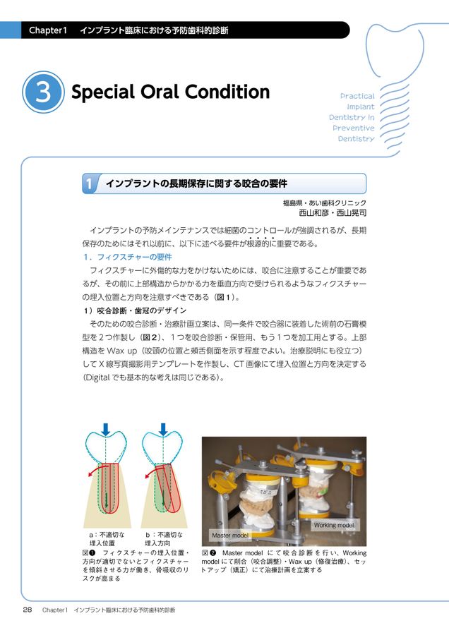 口腔インプラント臨床における予防歯科～長期安定のための診断と