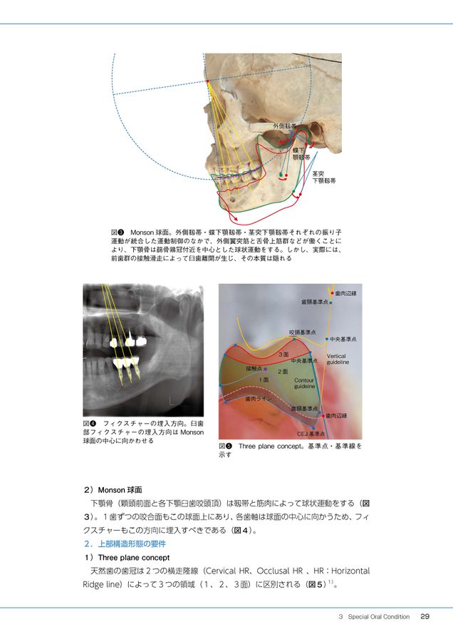 口腔インプラント臨床における予防歯科長期安定のための診断と術後管理 口腔インプラント臨床における予防歯科～長期安定のための診断と