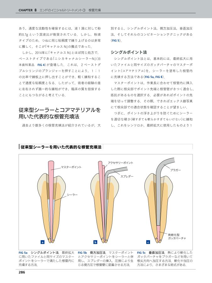 治癒の歯内療法 第3版