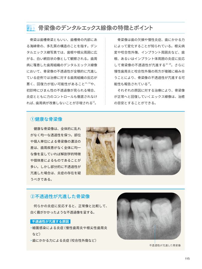 デンタル 歯科 骨格 X線の写真素材 - PIXTA