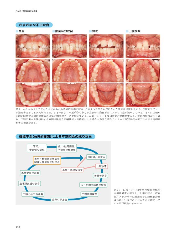 どう診る？ どう育てる？ 子どもたちの歯列と口腔機能