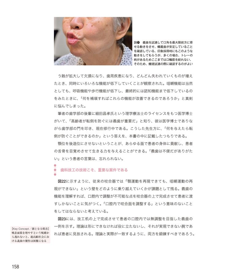 舌骨から紐解く顎機能の謎 丸茂義二のファイナルアンサー