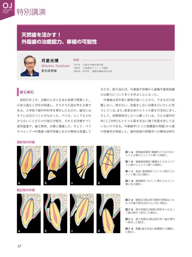 天然歯を活かしたインプラント治療