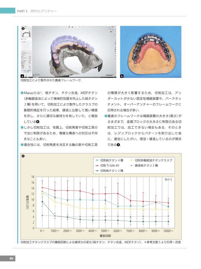 最新IRPDインプラントパーシャルデンチャーの実践 最新IRPDインプラントパーシャルデンチャーの実践