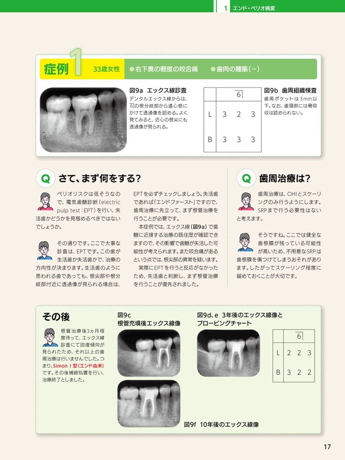 歯ブラシコーディネート術と歯周ポケット鑑別ガイド 楽天市場】IKMT 歯ブラシ 豚毛 ふつう 超コンパクトヘッド◇3本