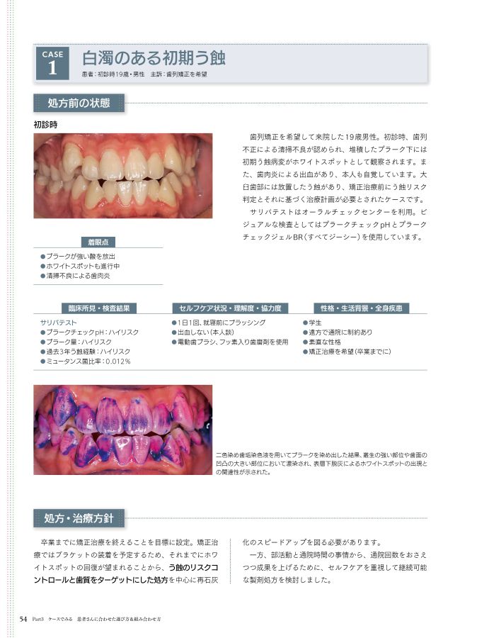 歯磨剤選び方ガイド