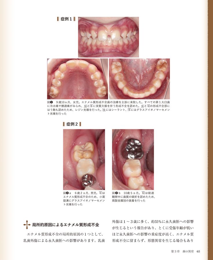 臨床の玉手匣 小児歯科篇 臨床の玉手匣 小児歯科篇| 歯科総合出版社 デンタルダイヤモンド社