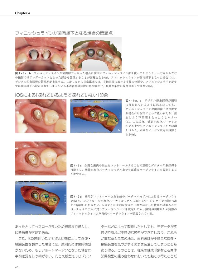 口腔内スキャナーはじめて講座_コピー