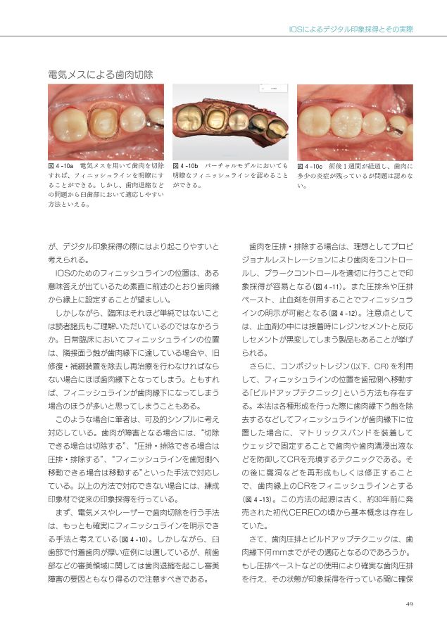 口腔内スキャナーはじめて講座_コピー