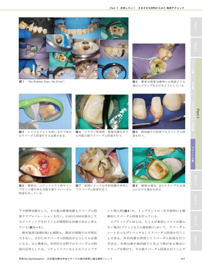 日本歯内療法学会がすべての歯科医師に贈る最新トレンド
