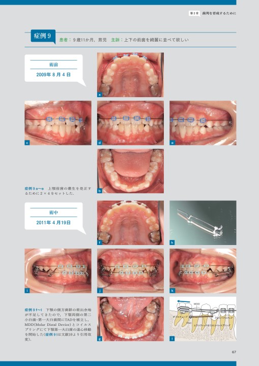 天然歯にこだわるGPの総合歯科臨床 = GENERAL DENTAL PRAC… 健康・医学