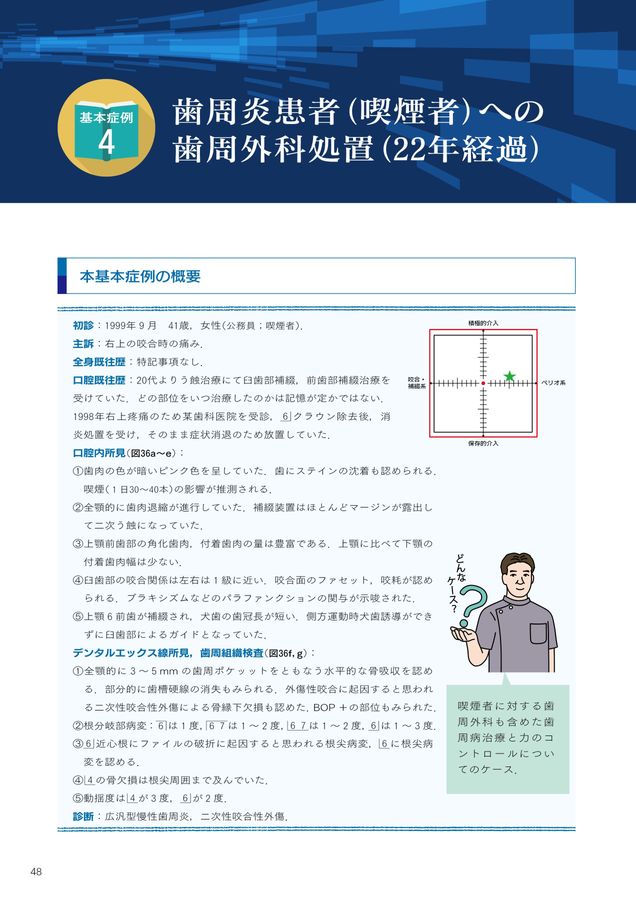 ペリオ＆咬合全顎ケースに悩んだ時に読む本