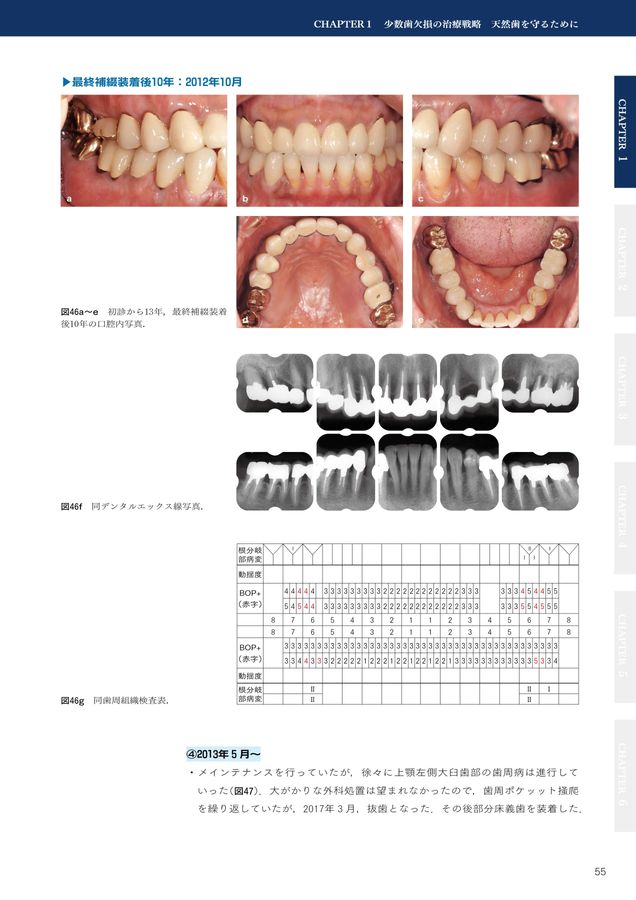 ペリオ＆咬合全顎ケースに悩んだ時に読む本