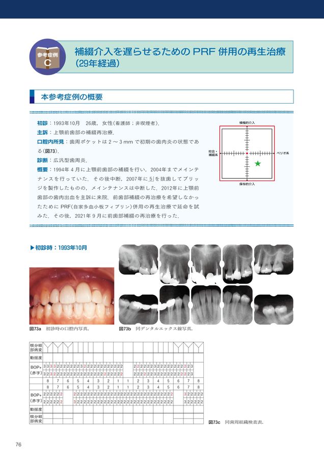 ペリオ＆咬合全顎ケースに悩んだ時に読む本