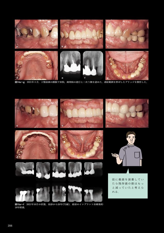 ペリオ＆咬合全顎ケースに悩んだ時に読む本