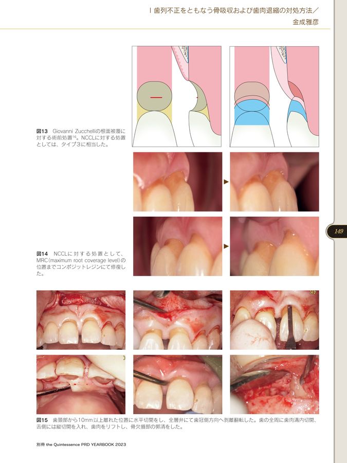 TQ別冊PRDYB2023