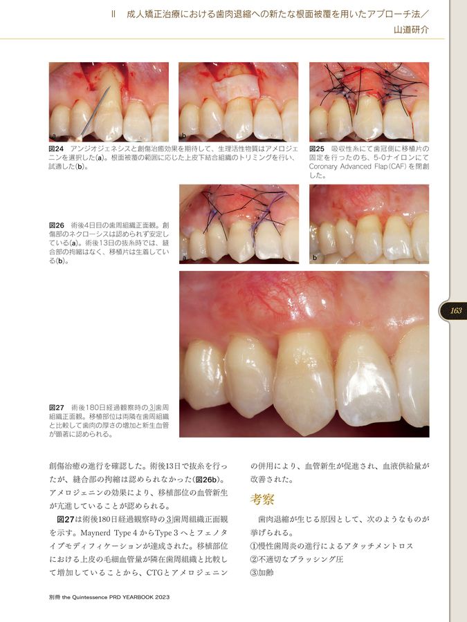 TQ別冊PRDYB2023