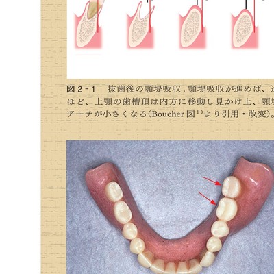 よい義歯 だめな義歯 鈴木哲也のよい義歯だめな義歯2 | 鈴木 哲也, 古屋 純一 |本