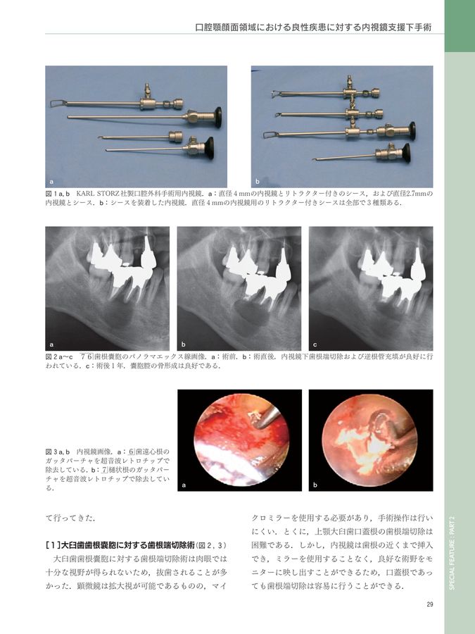 口腔洗浄器 歯垢除去 ジェットウォッシャー タンクレス (現役