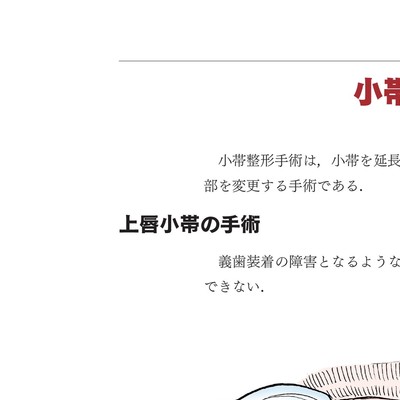 イラストでみる口腔外科手術 第3巻 イラストでみる口腔外科手術 第3巻