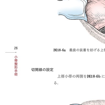 イラストでみる口腔外科手術 第3巻 イラストでみる口腔外科手術 第3巻