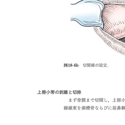 イラストでみる口腔外科手術 第3巻