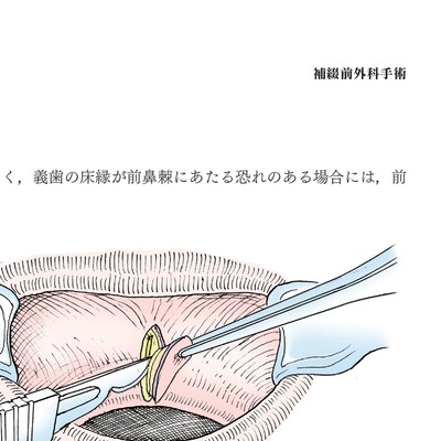 イラストでみる口腔外科手術 第1巻の購入ならWHITE CROSS