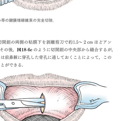 イラストでみる口腔外科手術 第3巻