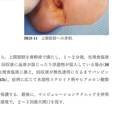 イラストでみる口腔外科手術 第1,2,3,4巻　裁断済 イラストでみる口腔外科手術 第2巻 | 日本口腔外科学会, 野間