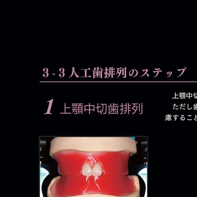 保険総義歯のススメ
