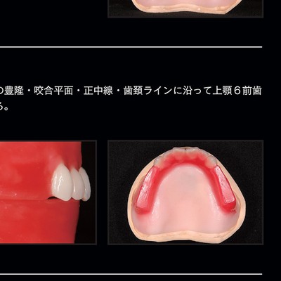 保険総義歯のススメ 保険総義歯のススメ | 河原 英雄, 松岡 金次, 河原 昌二, 須呂