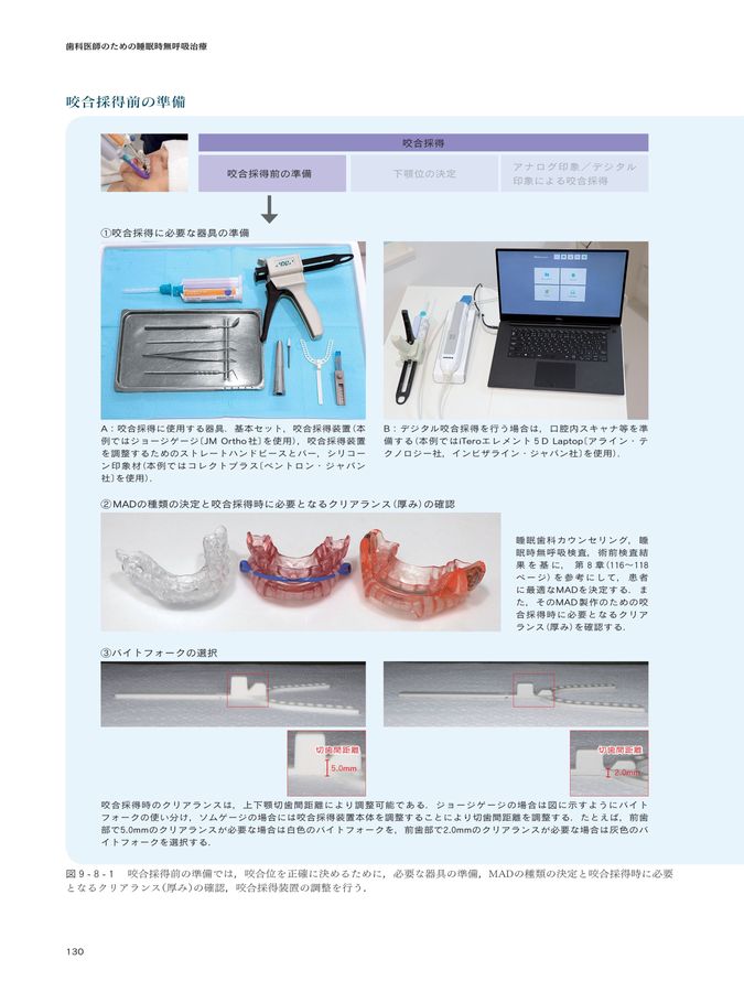 図解・咬合採得 シエン社 | 図解・咬合採得