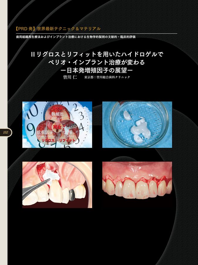 歯周・インプラント治療における再生療法 歯周・インプラント治療における再生療法（歯周・インプラント