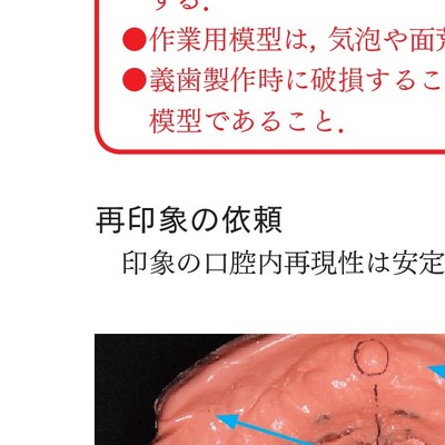 ポケット版 歯科技工士のための総義歯製作テクニック