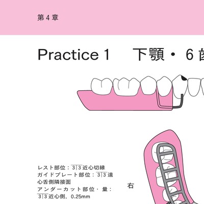 歯科医師　歯科技工士のためのパーシャルデンチャー練習帳 歯科医師・歯科技工士のためのパーシャルデンチャー練習帳