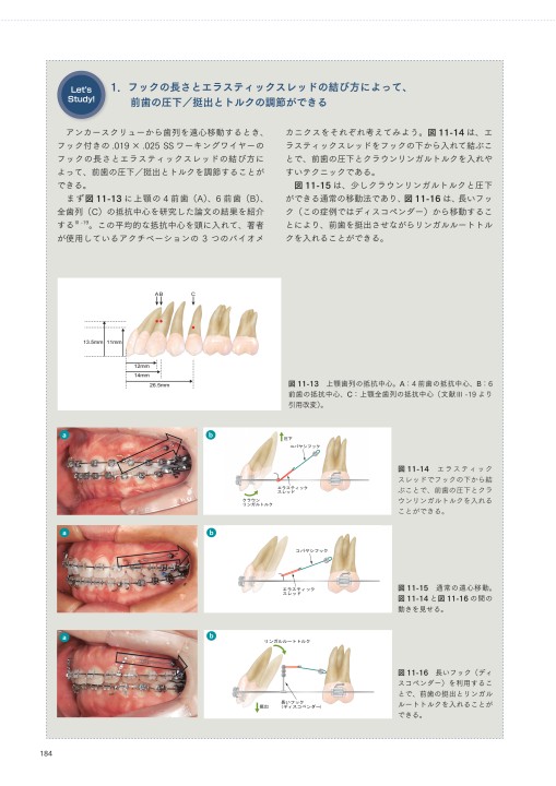 生体にやさしい戦略的矯正歯科治療歯科矯正用アンカースクリュー
