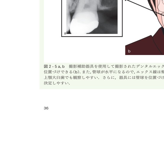 臨床で困らない歯内療法の基礎