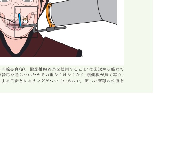 臨床で困らない歯内療法の基礎