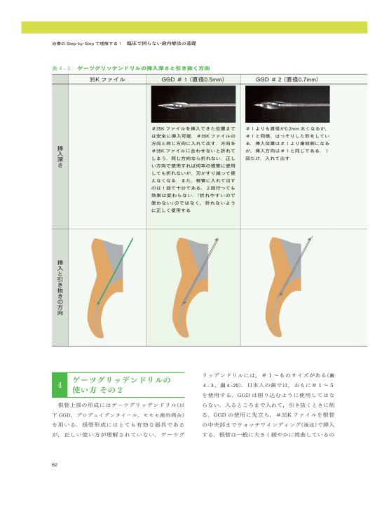 臨床で困らない歯内療法の基礎 | 吉岡 隆知 |本 | 通販 | Amazon