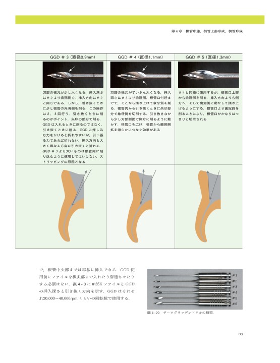 臨床で困らない歯内療法の基礎 臨床で困らない歯内療法の基礎 - クインテッセンス出版