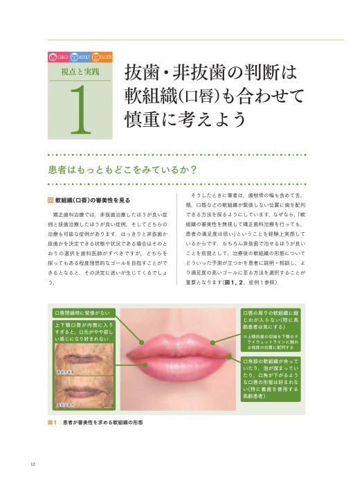 無理しない」「無駄にしない」矯正歯科治療13の視点と実践例