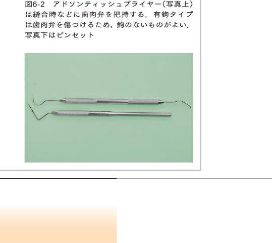 歯周外科 見て学んで始めるガイド