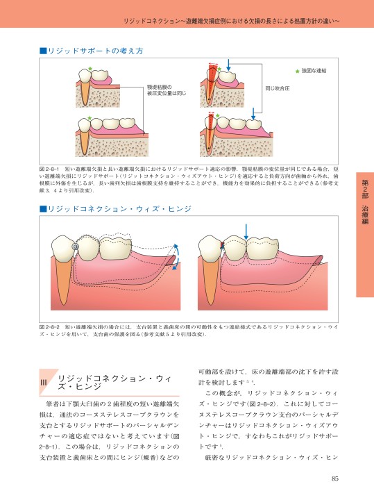 Amazon.com: パーシャルデンチャー治療 失敗回避のための