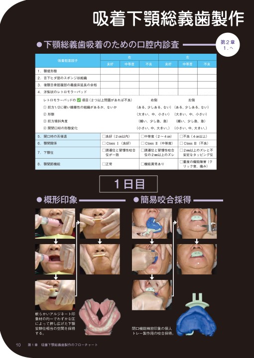 Suction Denture パーフェクトガイド
