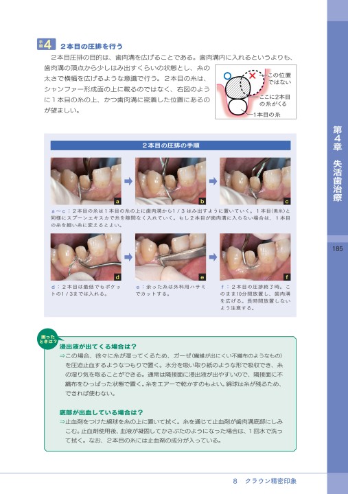 生涯歯を残せる時代の5つのスキル